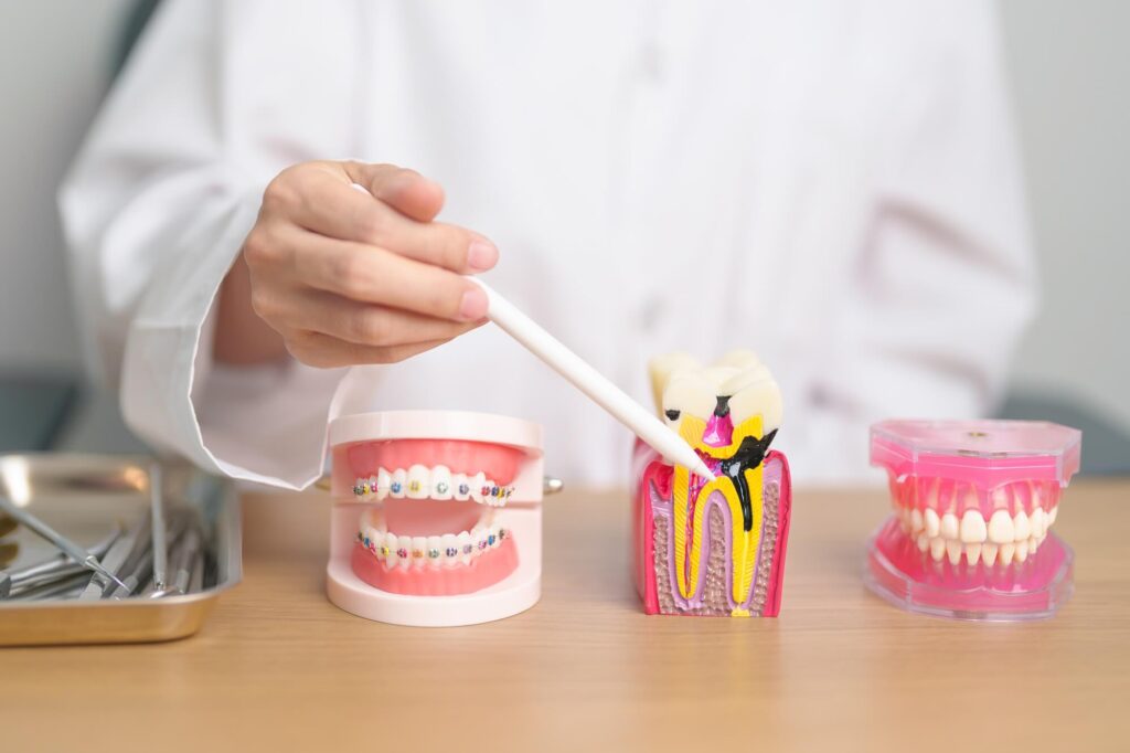 root-canal-treatment-hamilton-family-dental-1